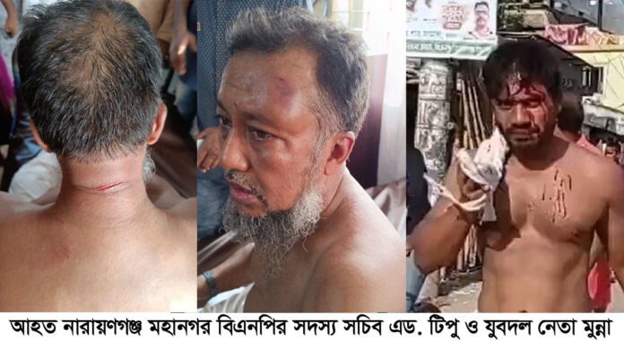 নারায়ণগঞ্জ মহানগর বিএনপির সদস্য সচিব টিপু সহ নেতাকর্মীদের উপর হামলা
