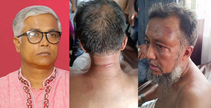 মুকুল-আশা হত্যার উদ্দেশ্যে পরিকল্পিতভাবে টিপুর উপর হামলা চালিয়েছে: এড. সাখাওয়াত