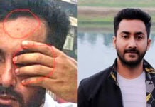 চোখে গুলি লাগার পরও দমে যাননি রাকিবুর রহমান সাগর চোখে গুলি লাগার পরও দমে যাননি রাকিবুর রহমান সাগর