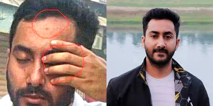 চোখে গুলি লাগার পরও দমে যাননি রাকিবুর রহমান সাগর