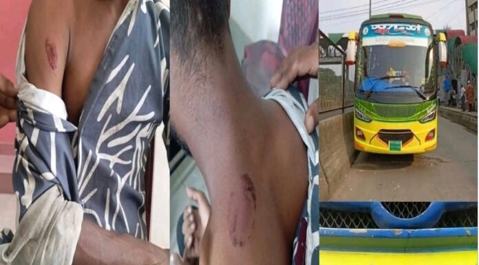 sonargaon-swadesh-paribahan-driver-bites-passenger যাত্রীকে কামড়ে আহত করার অভিযোগ চালকের বিরুদ্ধে